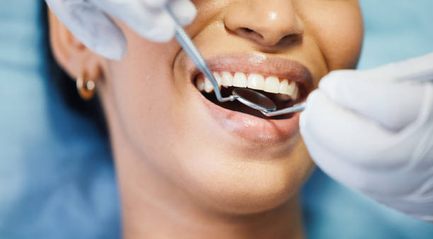 Best Urgent Dental Care for Toothaches in Silver Spring, MD