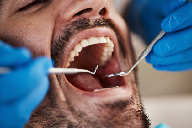 Best Walk-In Emergency Dental Services in Silver Spring, MD