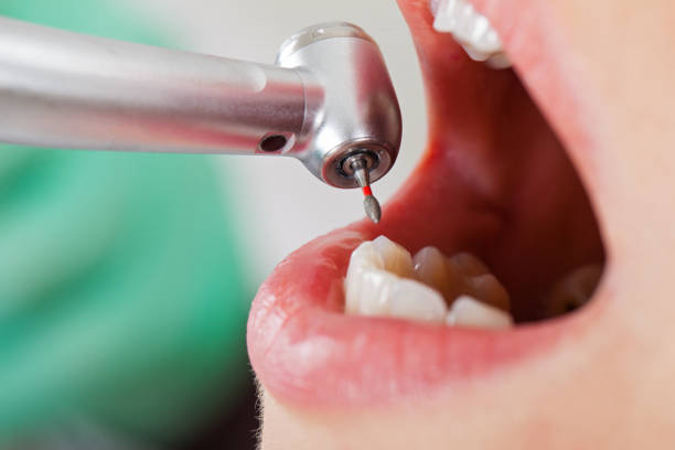 Best Emergency Treatment for Oral Infections in Silver Spring, MD